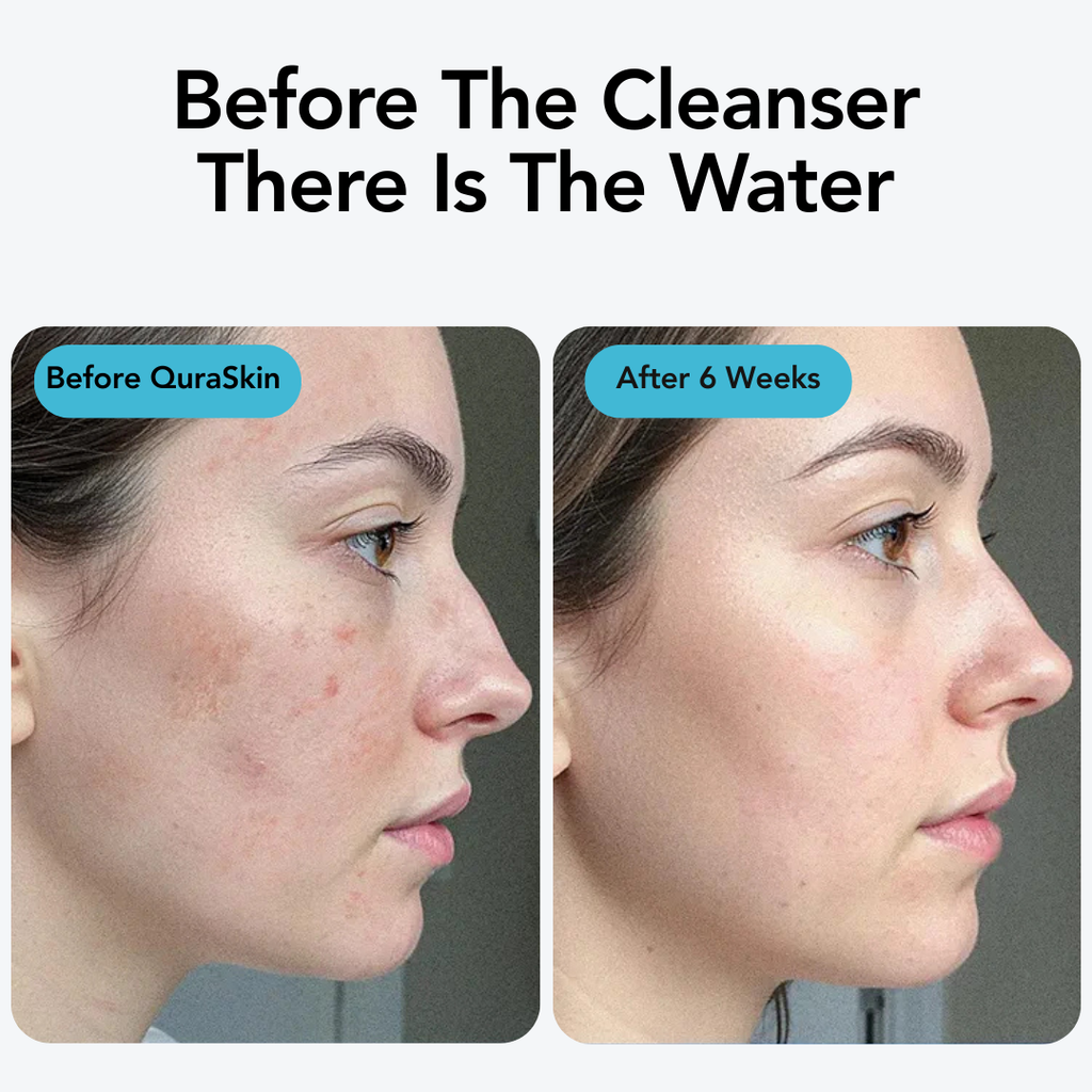 QuraSkin Filtered Showerhead